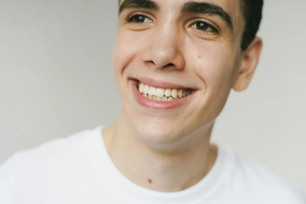 ¿Cuánto dura un blanqueamiento dental?