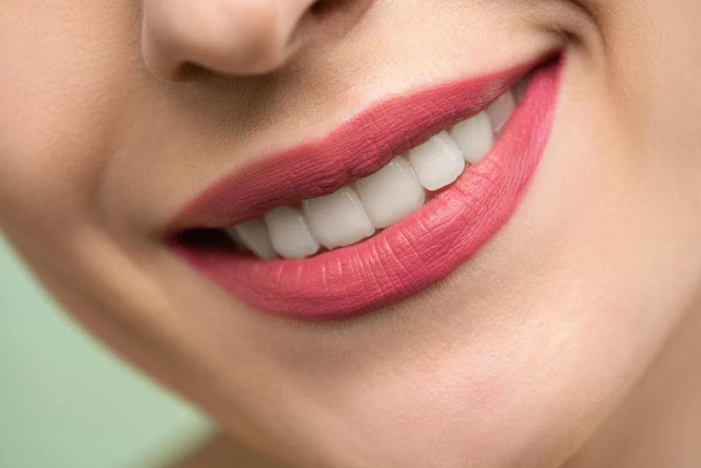 ¿Qué es el blanqueamiento dental?